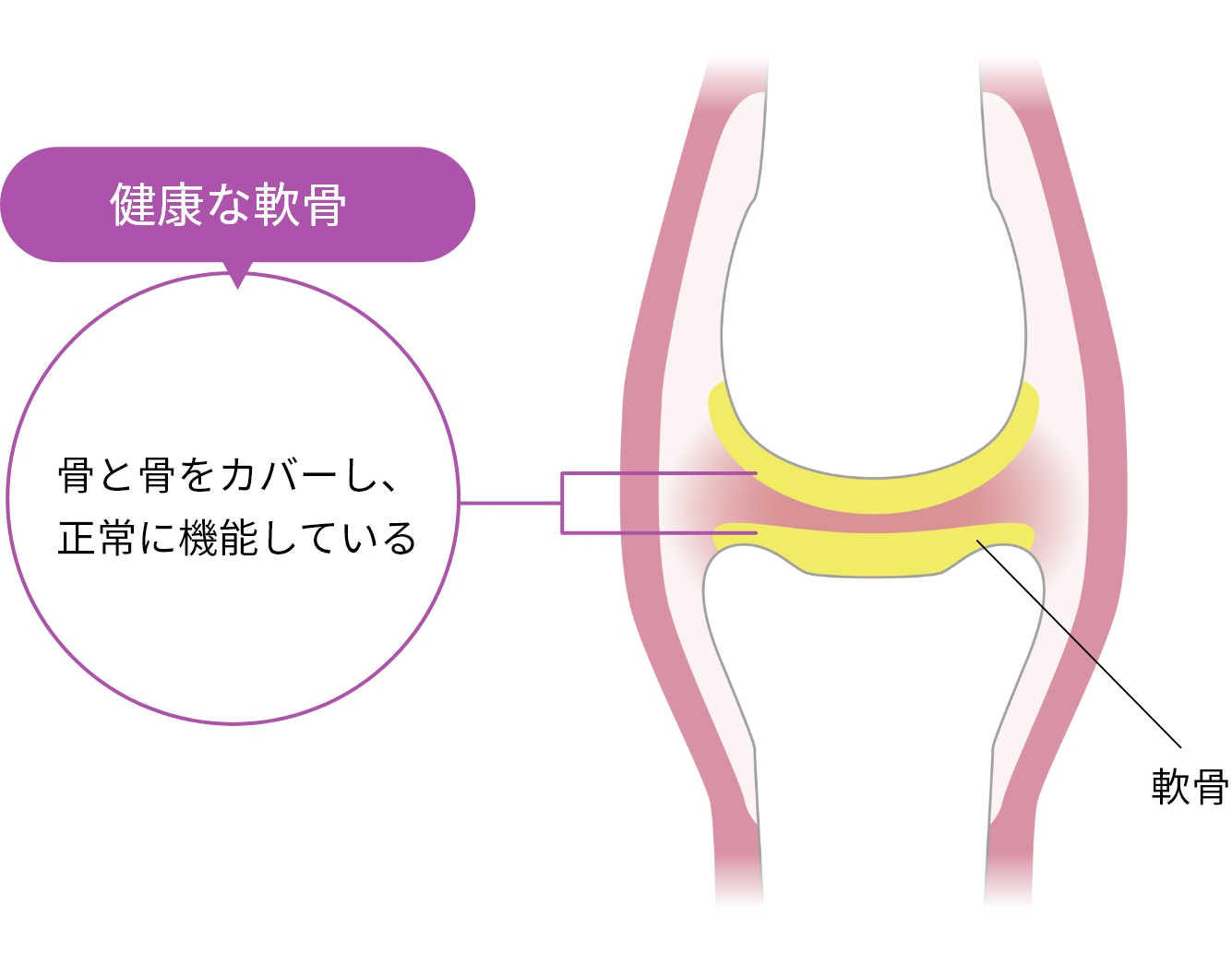 イメージ：軟骨